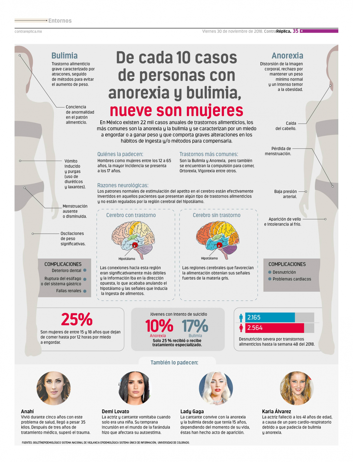 Infografías De cada 10 casos de personas con anorexia y bulimia